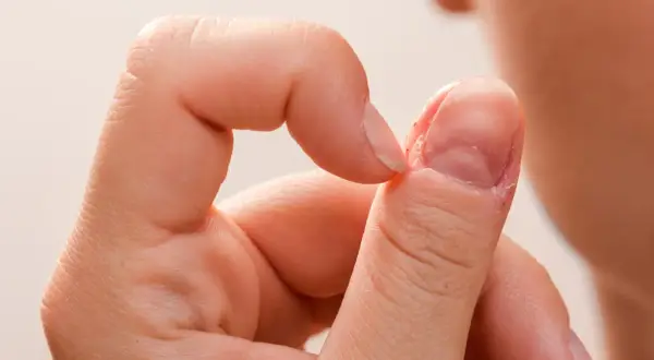 Chropowate paznokcie i sucha skóra wokół nich. Palec wskazujący dotyka kciuka, ukazując problem.